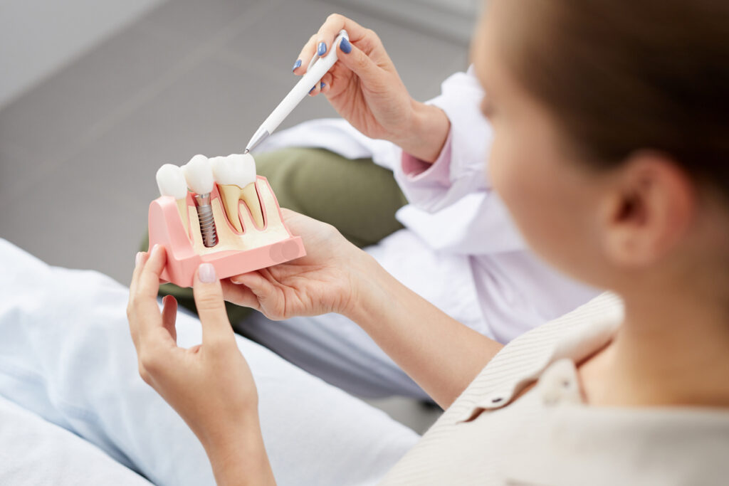 What are Dental Implants?
